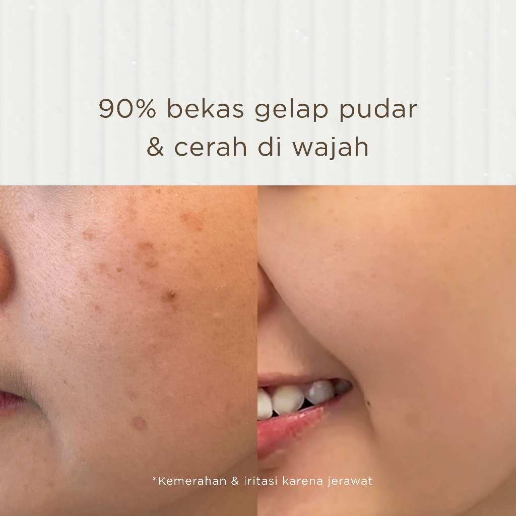 One Swipe 3-in-1 Cleansing Brightening Mousse