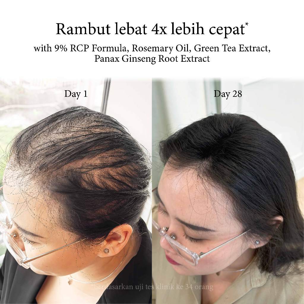 Ivy & Lily - Hair Loss & Growth Essence - 50ml | Hair Essence | Rambut Tipis | Sensitive Scalp | Hair Care