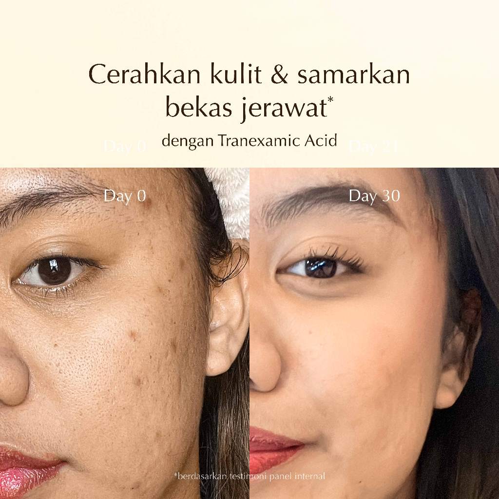 Tea Tree Purifying Clay Mask and Cleanser