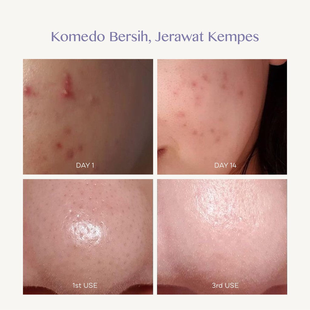 EILEEN GRACE - Moisturize Rose Jelly Mask + Deep-Cleansing Black Jelly Mask 300ml