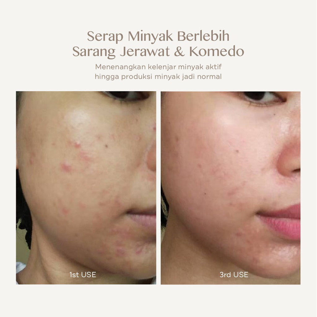 EILEEN GRACE - MA+ Essence 30ml