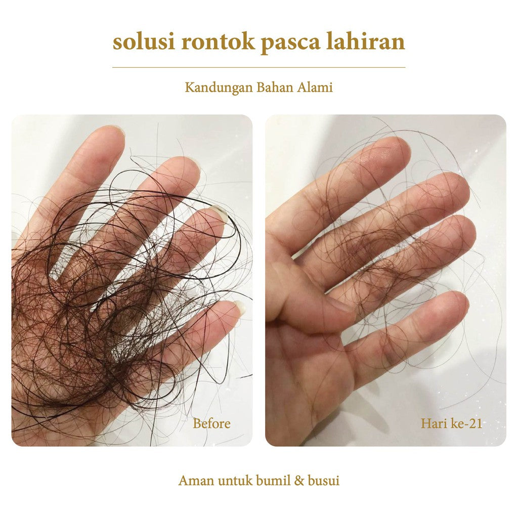 MISS DAISY | Anti Rontok Wangi Tahan Lama 12 Jam | Bulgarian Rose & Oud Perfume Shampoo 500ml