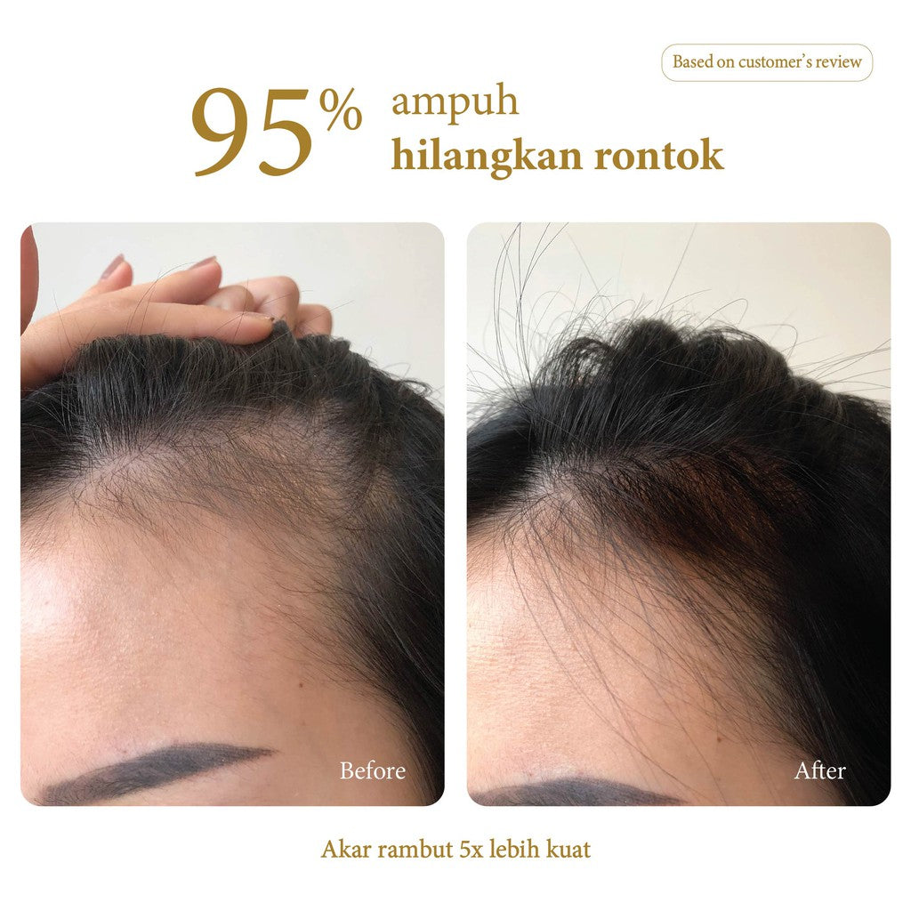 MISS DAISY | Anti Rontok Anti Lepek Wangi Tahan Lama 12 Jam | French Perfume Shampoo