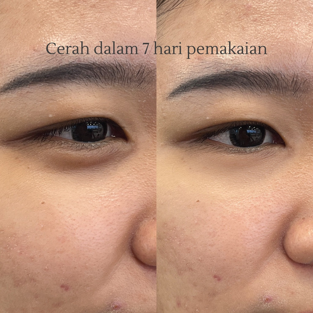 Swissvita Eye Cream VitaBtech