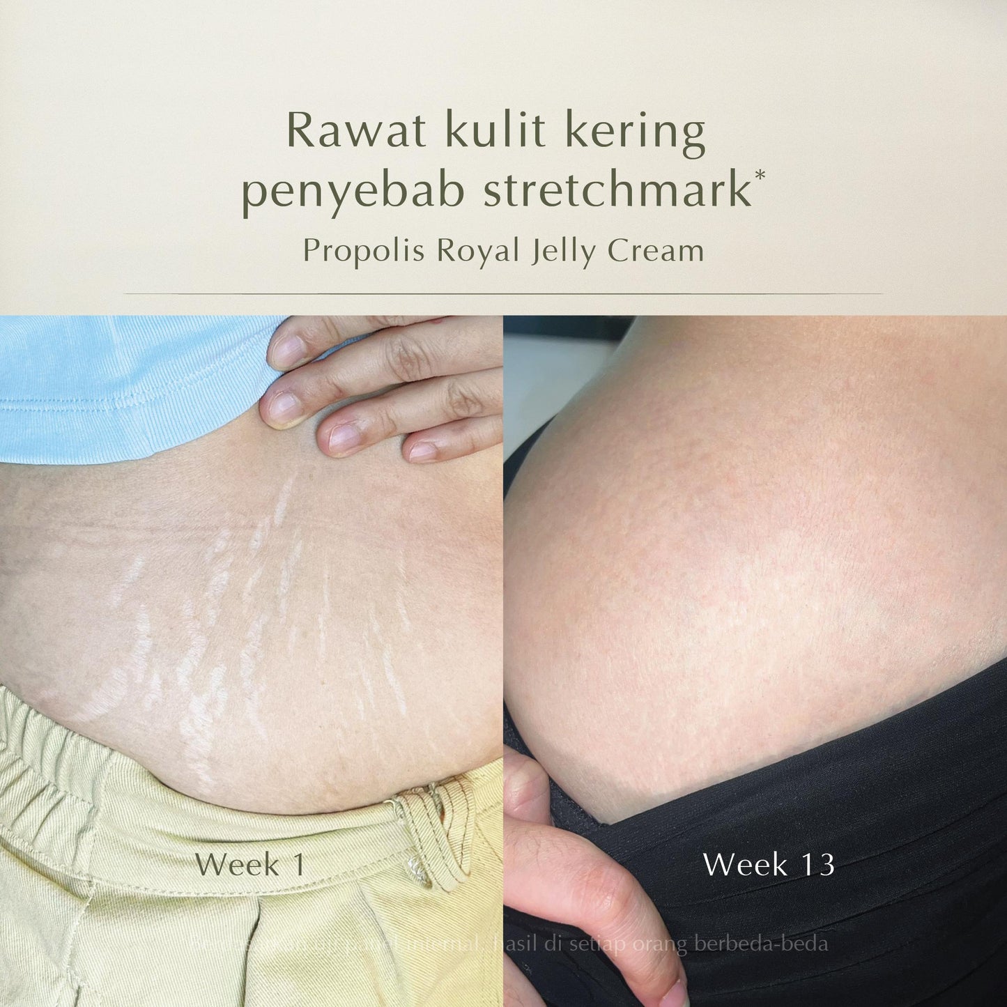 [NEW LAUNCH] Mossèru - Royal Jelly Body Cream - Body Butter 170gr | Pelembap Badan | Anti Aging | Body Serum | Body Lotion | Brightening Lotion | Hand Body | Body Care