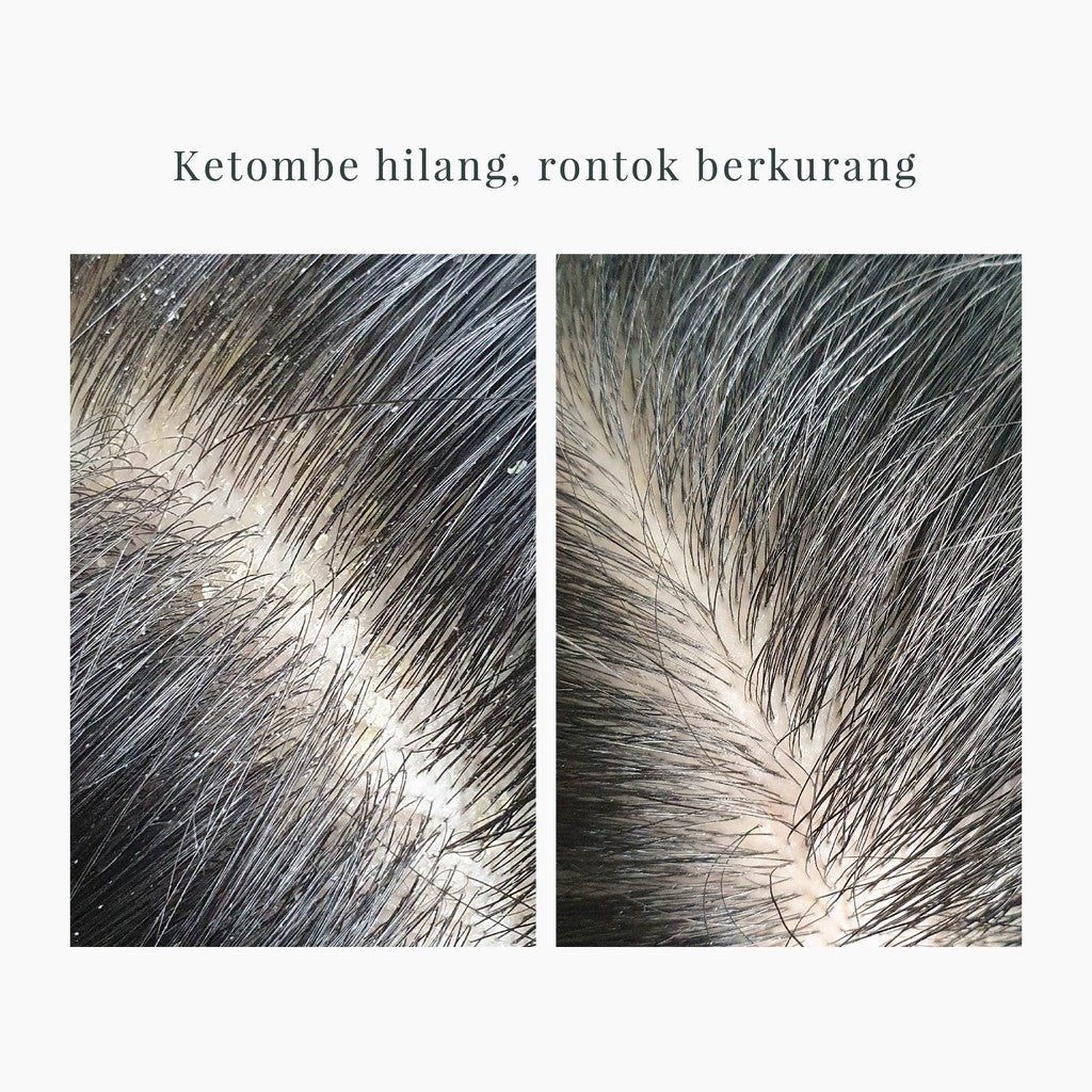 SHRD Nutra Therapy Collagen Shampoo 15ml x 1 | Anti Rontok & Ketombe | Perawatan Rambut Kering,