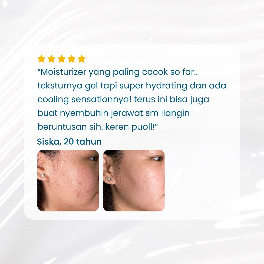5x Hyaluronic Moisture Lock Gel | Pelembap Muka | Meredakan Kulit Kering | Hyaluronic Acid | Mengurangi kemerahan | Menghilangkan Jerawat
