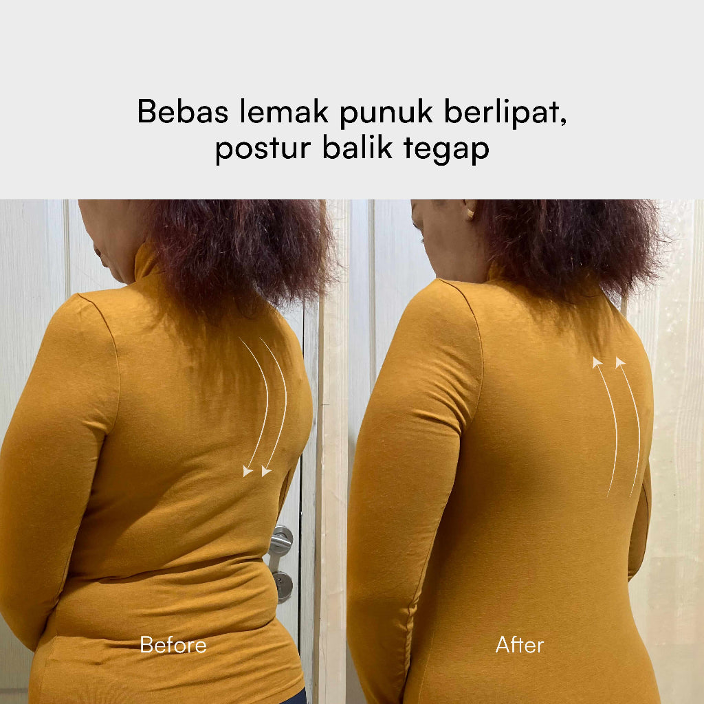 CHESS Bodyshaper / XL - Black / 2x LEBIH CEPAT LANGSING / Shapewear (Tanpa Tulang & Kawat) / Anti Gatal Ruam