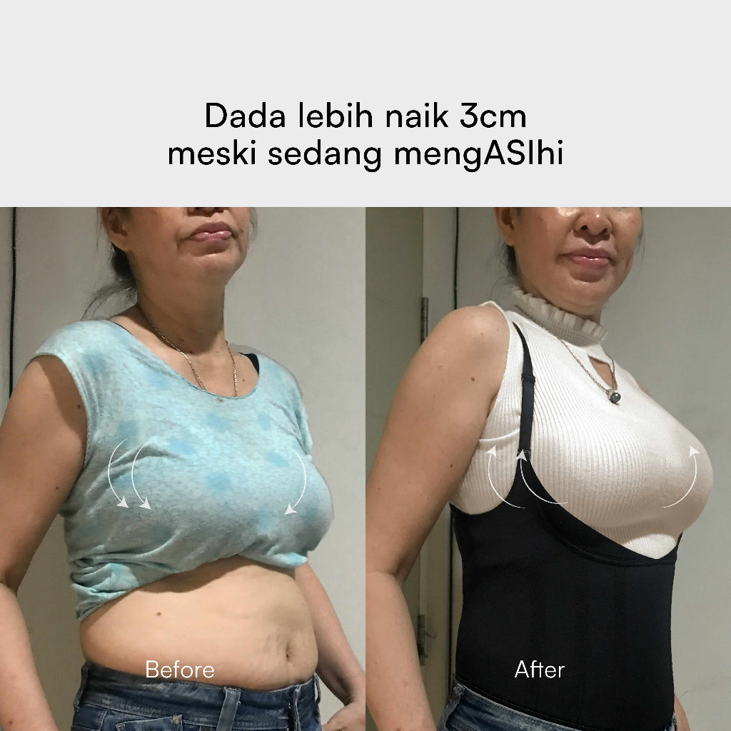 CHESS Bodyshaper / XL - Black / 2x LEBIH CEPAT LANGSING / Shapewear (Tanpa Tulang & Kawat) / Anti Gatal Ruam