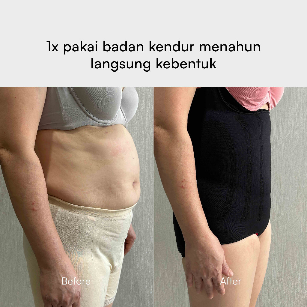 CHESS Bodyshaper / XL - Black / 2x LEBIH CEPAT LANGSING / Shapewear (Tanpa Tulang & Kawat) / Anti Gatal Ruam