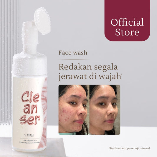 GBELLE | Face wash 3 in 1 Acne Mousse 150ml | Pembersih Wajah | Facial Wash | Face Massage | Kulit Berjerawat | Kulit Iritasi | Kemerahan | Melembapkan | Hydrating | Jerawat | Salicylic Acid