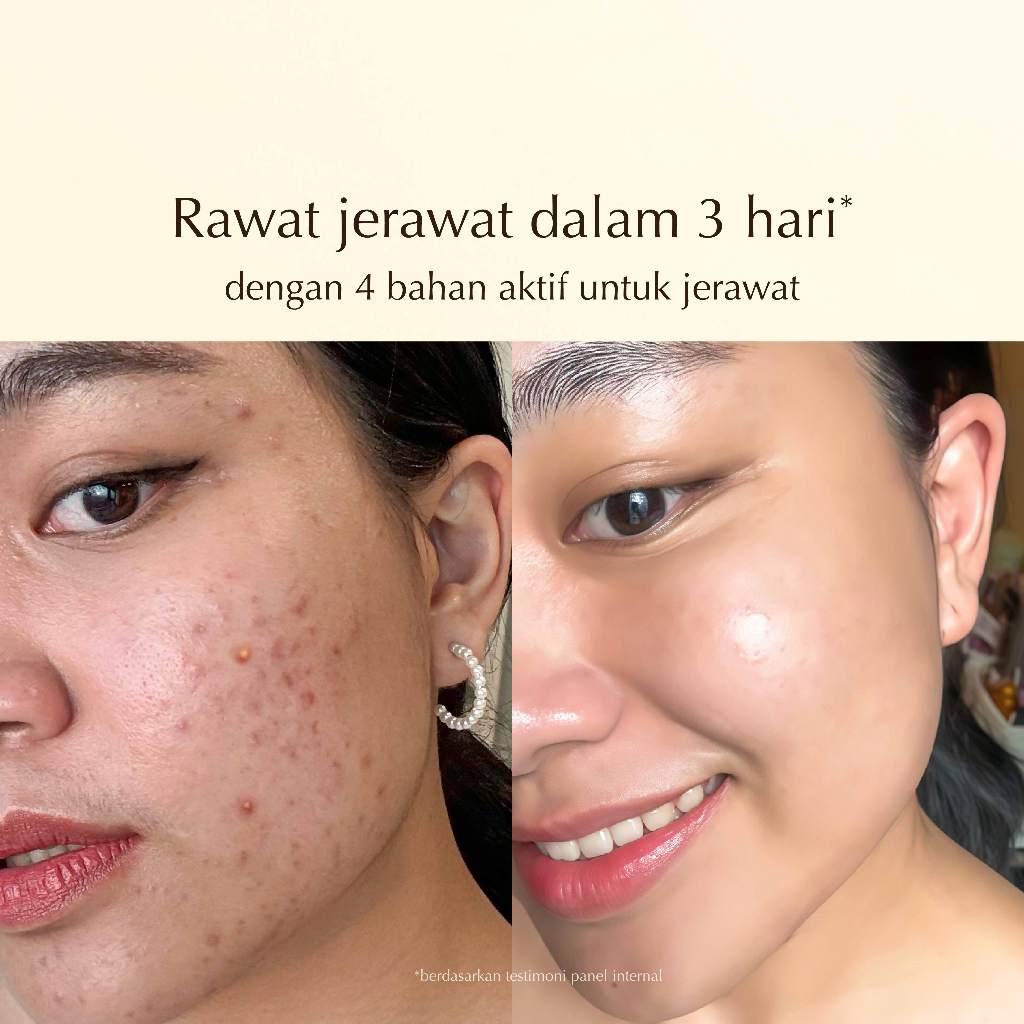 Tea Tree Blemish Lotion Precious